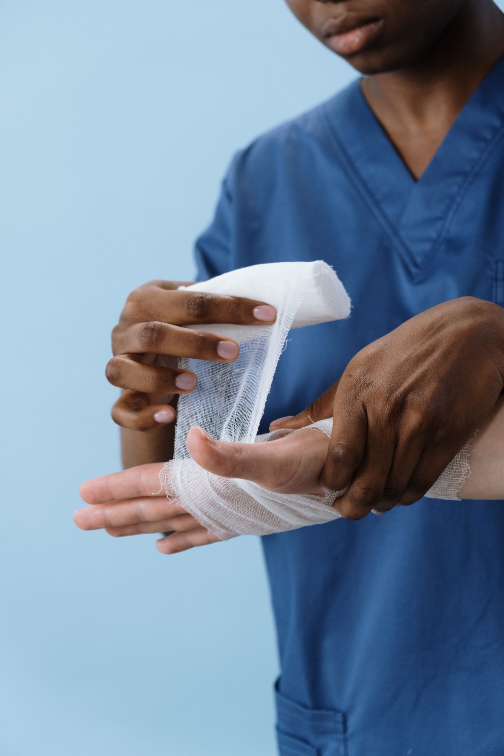 A hand loosely wrapped with gauze after cooling a burn