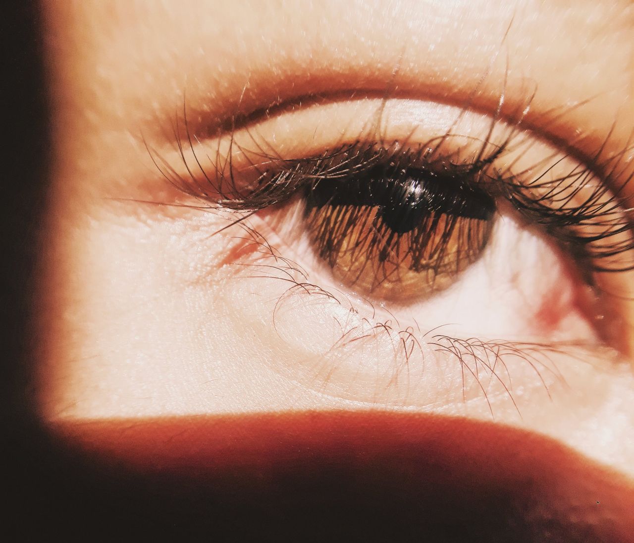 Close-up of a human eye being checked for a trapped particle